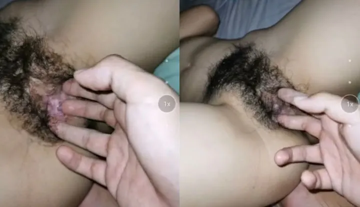 Ghi chép đầy đủ về cuộc châm cứu của hai vợ chồng